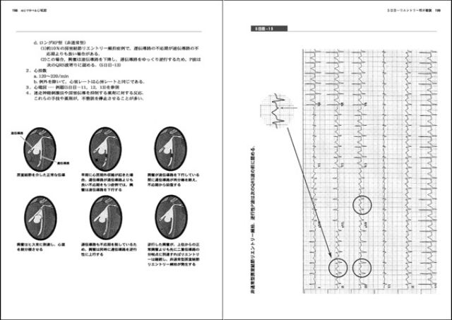 10日で学べる心電図―短期集中型ワークブック―｜株式会社総合医学社